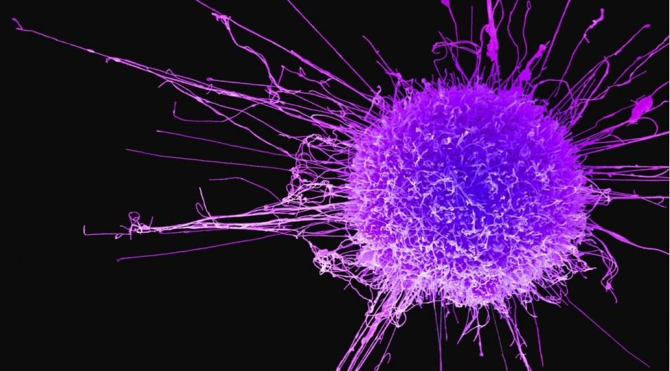 sumuk-xerchenginin-de-charesi-tapildi