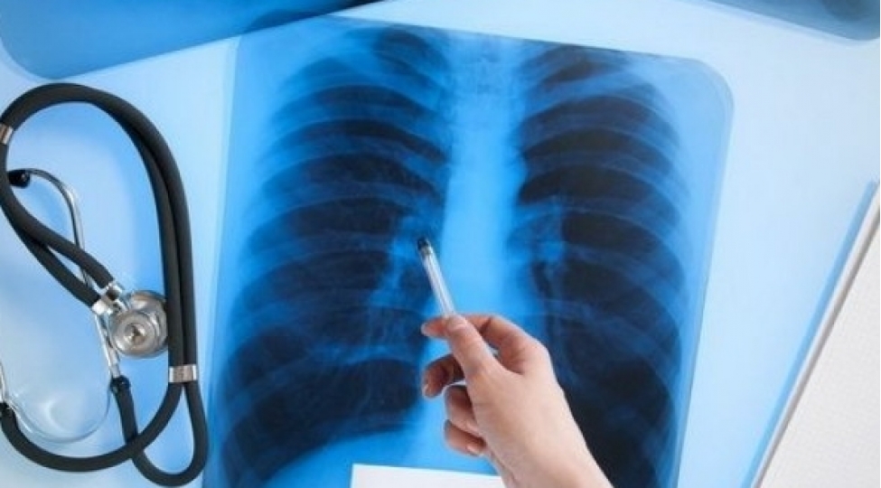 olke-uzre-3500-den-chox-veremli-xeste-dispanser-qeydiyyatina-alinib