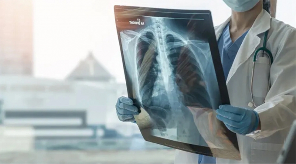 boyuk-britaniyada-vereme-yoluxma-hallari-keskin-artib