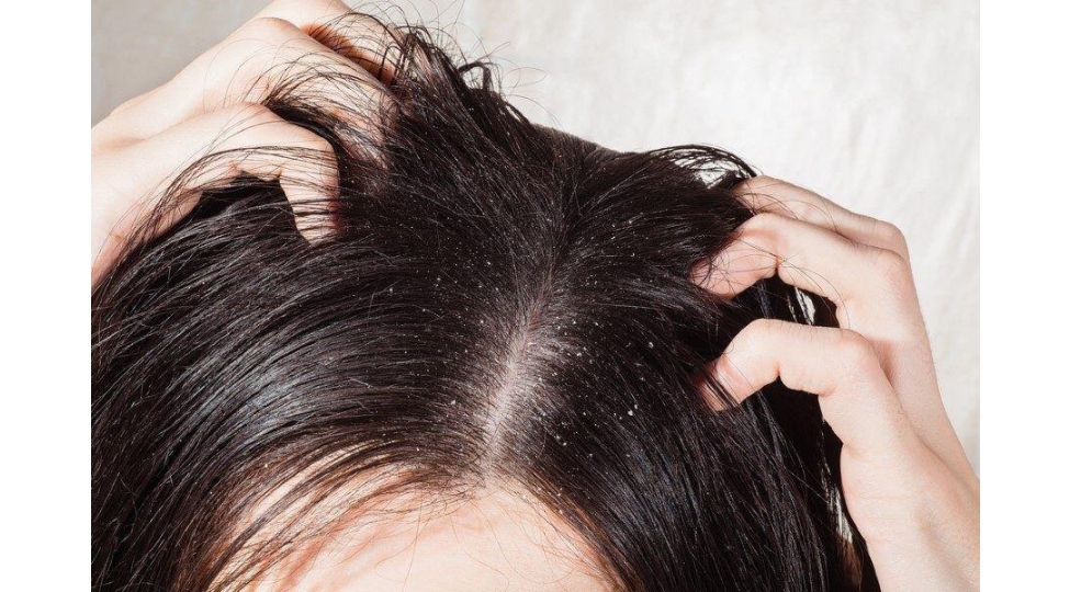 kepeyi-yox-eden-tebii-usullar